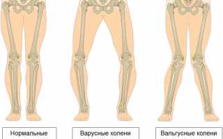 Комплекс упражнений для исправления кривизны ног и улучшения осанки