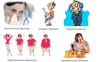 Как лечить артрит народными средствами? Полезные советы и рекомендации