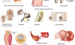 Как снять боль в пояснице народными средствами? Эффективные методы и советы