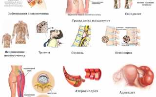 Как снять боль в пояснице народными средствами? Эффективные методы и советы
