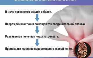 Почему болит поясница после употребления алкоголя? Узнайте причины и последствия