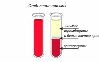 Лечение болезней суставов с помощью плазмолифтинга для улучшения здоровья