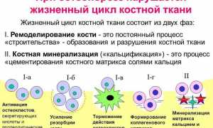 Классификация видов остеопороза: основные аспекты и особенности