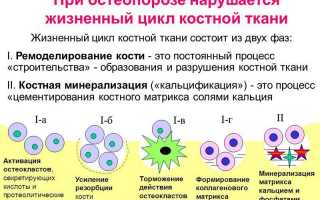 Классификация видов остеопороза: основные аспекты и особенности
