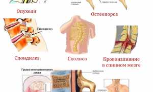 Компьютерная томография грудного отдела позвоночника: диагностика и преимущества