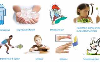 Почему руки сводит судорогой и как ее устранить: советы и рекомендации