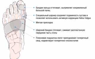 Вальгусная ортопедическая шина Hallufix: обзор изделия и его преимущества