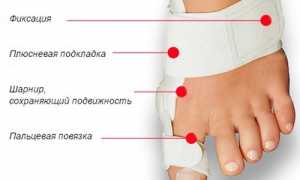 Шина Валюфикс от косточки на ноге: показания, отзывы и рекомендации