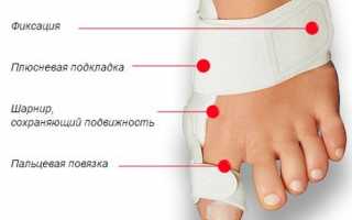 Шина Валюфикс от косточки на ноге: показания, отзывы и рекомендации