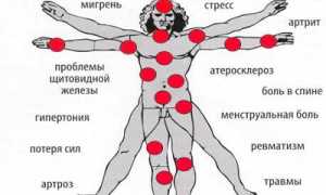 Можно ли применять Алмаг при грыже позвоночника для лечения?