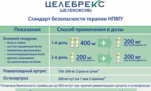 Описание аналогичных препаратов лекарства Целебрекс для лечения