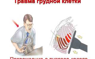 Первая помощь и лечение при переломе грудины: советы и рекомендации