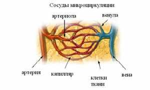 Лечение банками остеохондроза для здоровья и восстановления