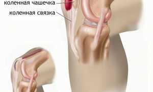 Что делать при боли в колене после тренировки? Полезные советы и рекомендации