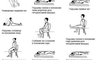 Как ходить на костылях после замены тазобедренного сустава? Полезные советы и рекомендации