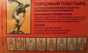 Применение перцового пластыря при лечении радикулита и его эффективность