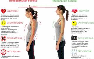 Комплекс упражнений для восстановления прямой осанки и улучшения здоровья