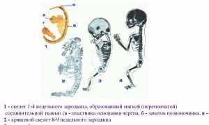 Симптомы конкресценции и методы ее коррекции: важные аспекты и рекомендации