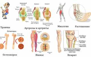 Выбираем действенную мазь при болях в суставах ног для эффективного облегчения