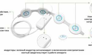 Помогает ли аппарат Алмаг-01 при переломах костей? Узнайте мнение врачей