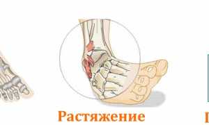 Как избавиться от боли в области щиколотки? Полезные советы и рекомендации.