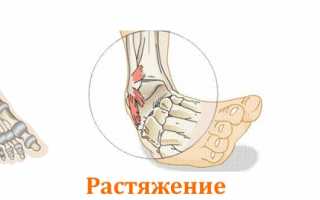 Как избавиться от боли в области щиколотки? Полезные советы и рекомендации.