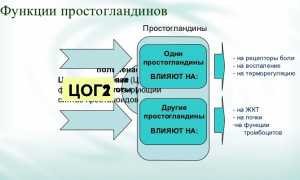 НПВП нового поколения при остеохондрозе и артрозе: эффективные решения для здоровья