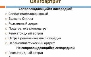Что такое олигоартрит суставов и его особенности?