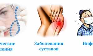 Признаки и лечение фиброзной дисплазии костей: важная информация для пациентов