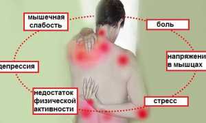 Признаки развития фибромиалгии и методы ее лечения для улучшения качества жизни