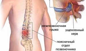 Подробное описание подушки Мейрама и ее применение в повседневной жизни