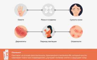 Почему горит ожог от пантенола