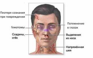 Оказание первой помощи и лечение при ушибе носа: советы и рекомендации
