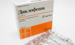 Применение Диклофенака при межреберной невралгии: особенности и рекомендации