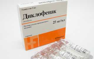 Применение Диклофенака при межреберной невралгии: особенности и рекомендации