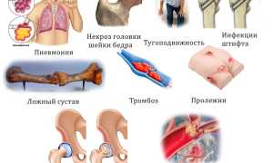 Меры по восстановлению после перелома шейки бедра для быстрого выздоровления