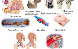 Меры по восстановлению после перелома шейки бедра для быстрого выздоровления