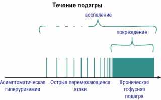 Препарат Колхицин — эффективное средство при подагре и её симптомах