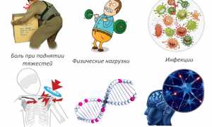 Особенности проявления и лечение бурсита плеча: советы и рекомендации