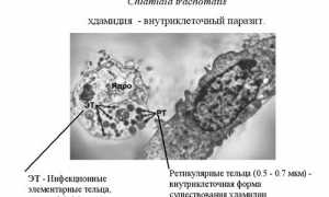 Симптомы и лечение хламидийного артрита суставов: полезная информация для пациентов