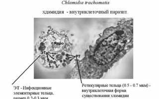 Симптомы и лечение хламидийного артрита суставов: полезная информация для пациентов