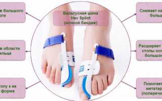 Применение ночного фиксатора Hav Splint при вальгусной стопе для улучшения здоровья