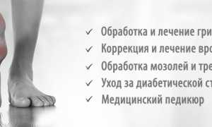 Кто такой подолог и с какими болезнями к нему обращаются? Узнайте больше о профессии