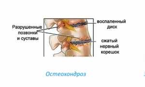 От чего помогает лекарственный препарат Кетодексал? Узнайте больше о его действии