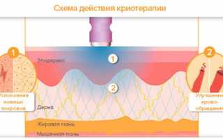Использование холода в целях лечения суставов и улучшения здоровья
