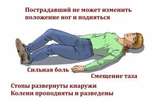 Восстановление после перелома седалищной кости: советы и рекомендации