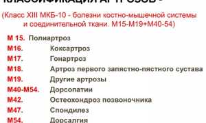 Почему развивается полиартроз у взрослых и как его лечить? Полезные советы и рекомендации