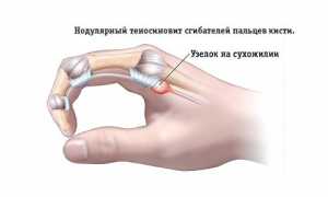 Что делать, если появились боли в области кисти руки? Полезные советы