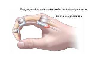 Что делать, если появились боли в области кисти руки? Полезные советы