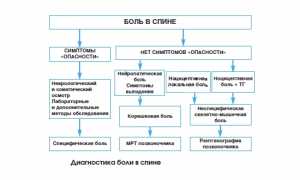 Почему болит в левом боку со спины и что с этим делать? Узнайте причины и советы